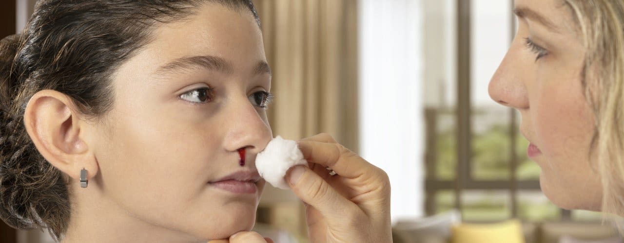 attachment-is-it-normal-for-children-to-have-nosebleeds-and-what-are-the-causes-1