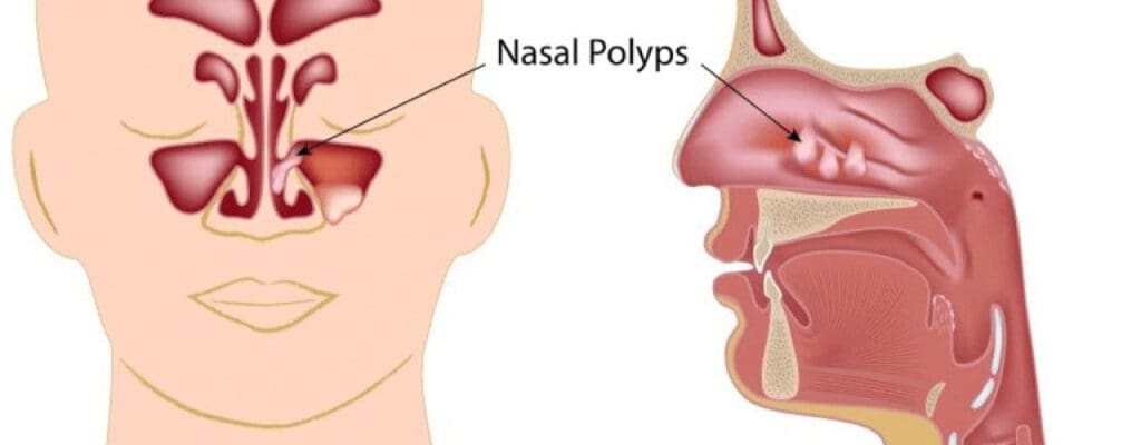 attachment-why-can-i-not-smell-anything