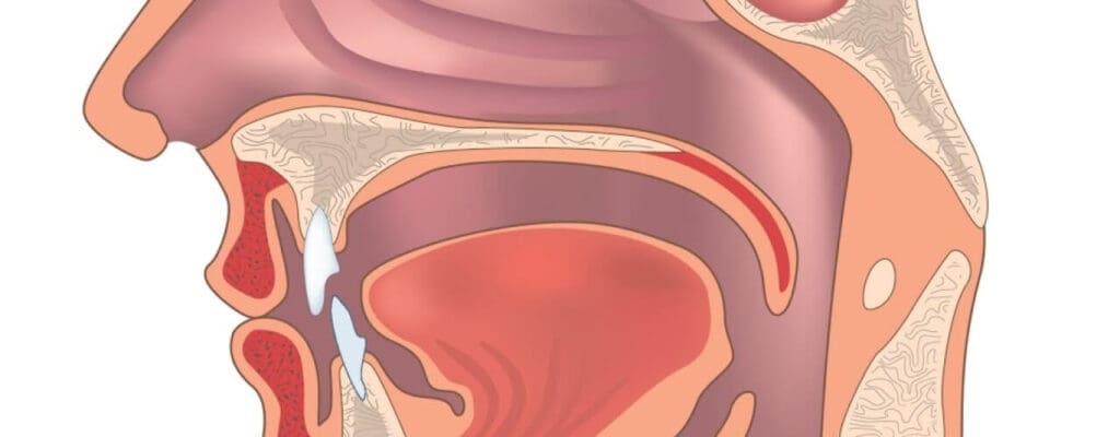 attachment-can-tobacco-cause-head-and-neck-cance