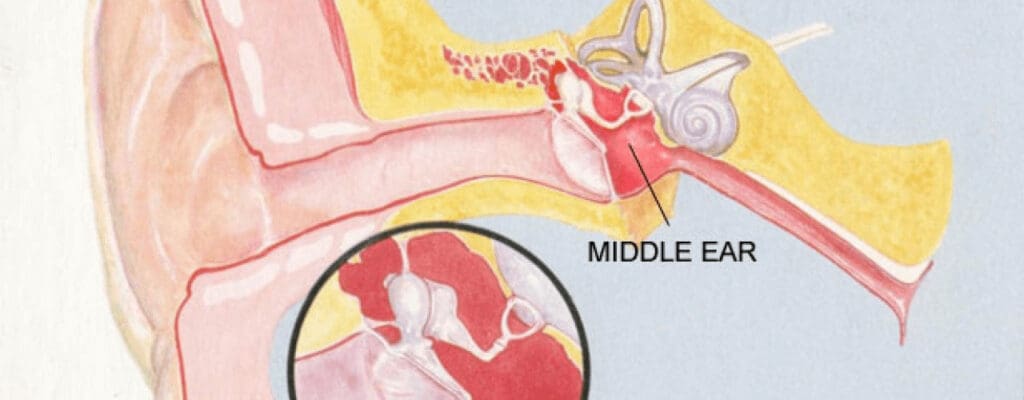 attachment-do-you-have-a-middle-ear-infection