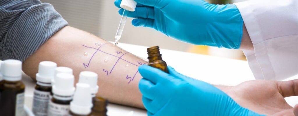 attachment-how-allergy-testing-can-help-prepare-for-the-common-illnesses