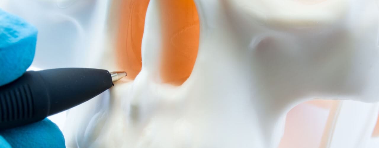 attachment-do-the-benefits-outweigh-the-risks-for-a-deviated-septum-surgery