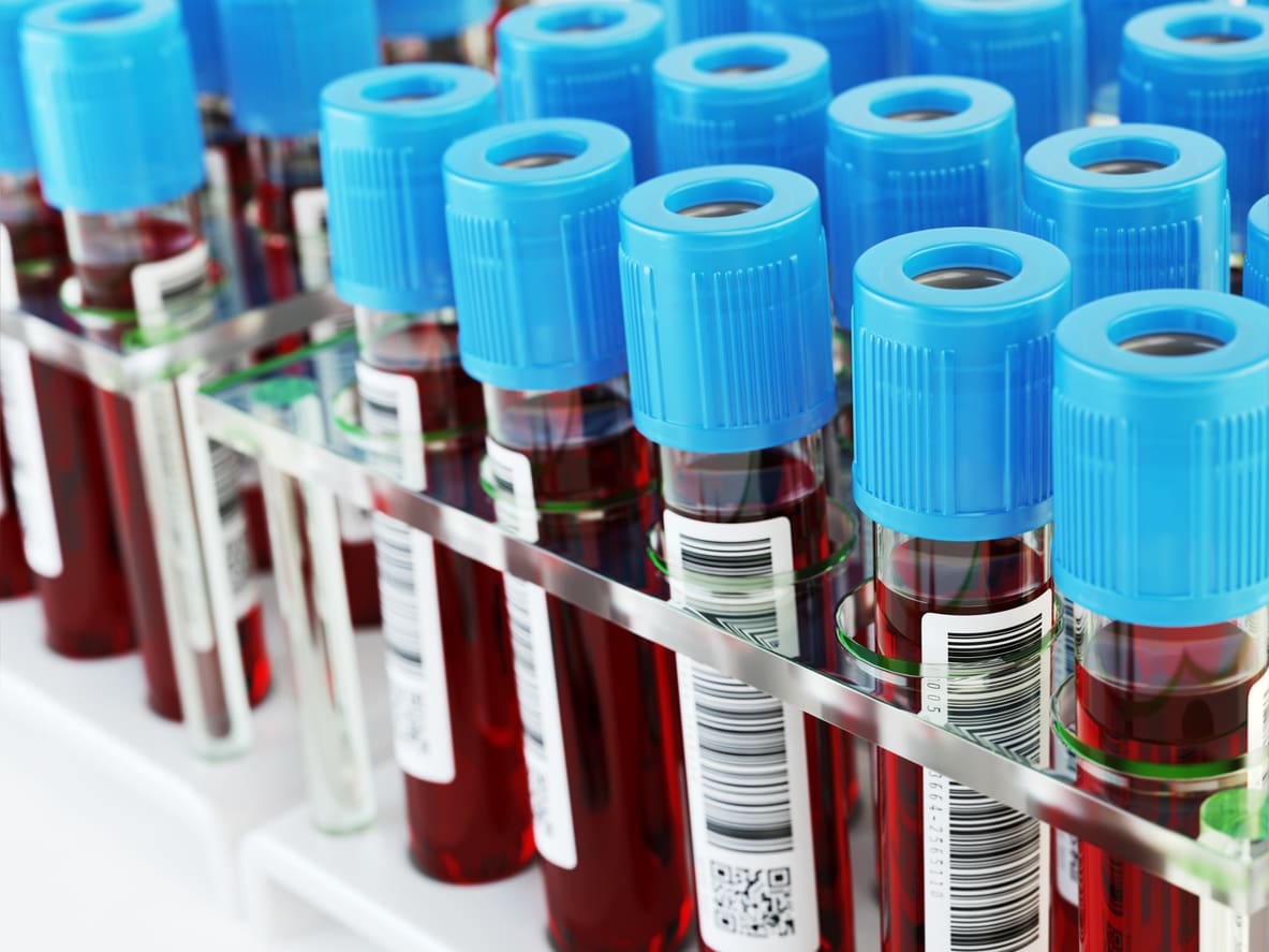 blood-test-tubes-samples-in-a-rack