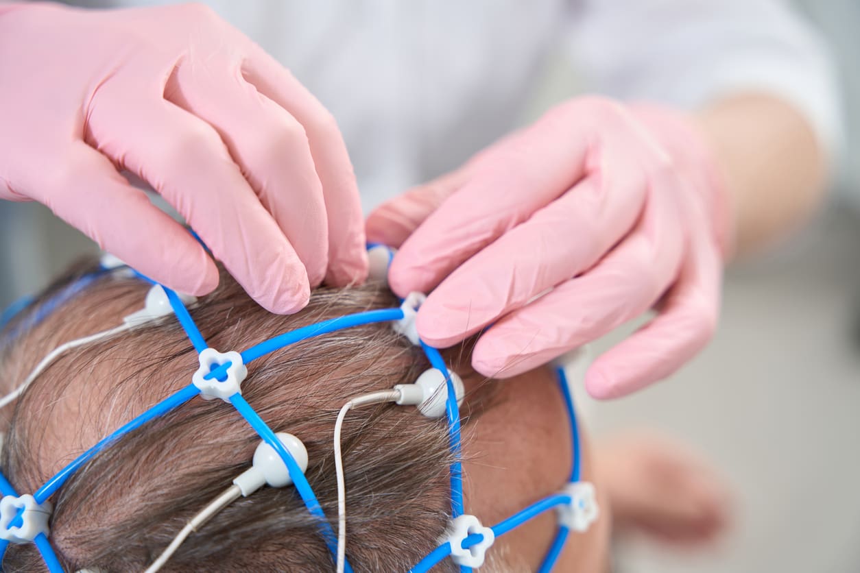 doctor-diagnostician-removes-electrodes-from-the-head-of-elderly-patient