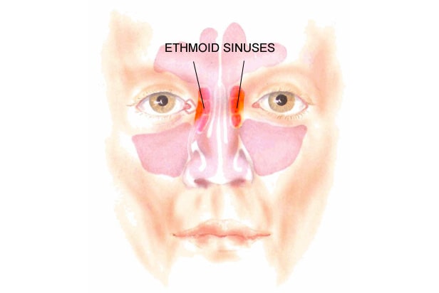 Ethmoid Sinuses