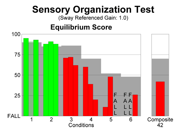 Posturography Sensory Organisation Test Harley Street ENT Clinic figure-1-from-changes-in-sensory-organization-test-scores-with-age